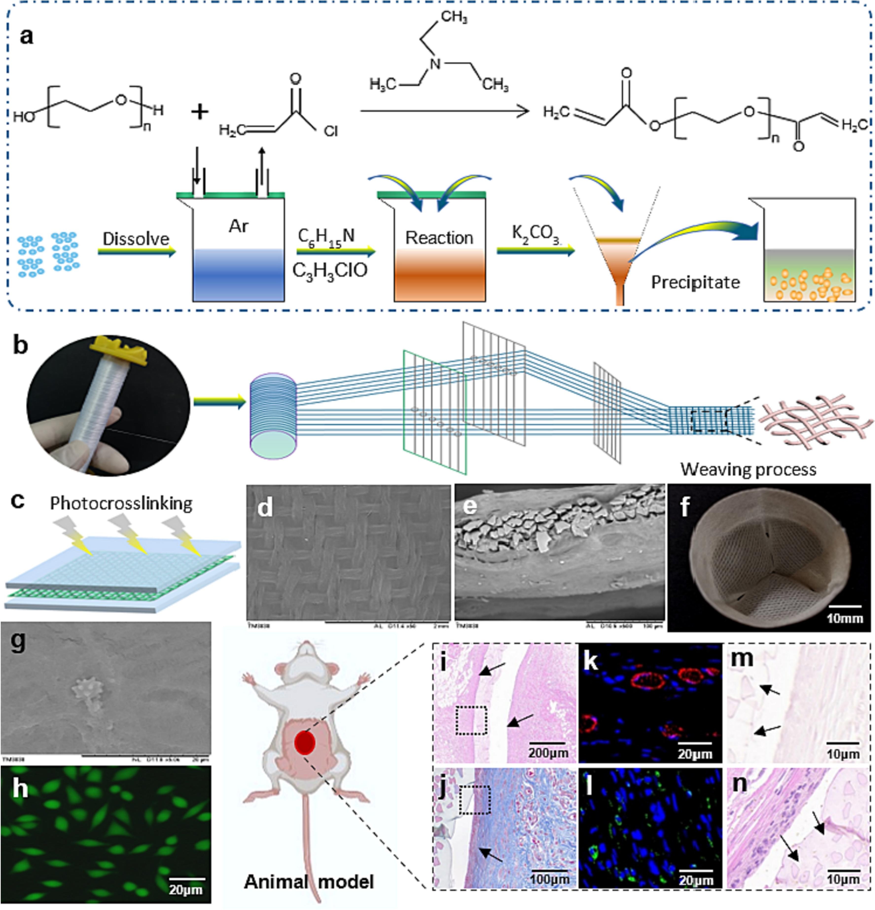 Sun X, Huang D, Li GQ, Sun J, Zhang YY, Hu B, Xie MB, Zhao MD, Zhang XC, Yu J, Li G. Artificial heart valve reinforced with silk woven fabric and poly (ethylene glycol) diacrylate hydrogels composite.International Journal of Biological Macromolecules, 2024, 129485.